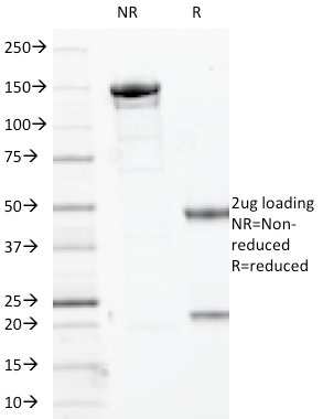 Data from SDS-PAGE analysis of Anti-Myogenin antibody (Clone MYOG/2660). Reducing lane (R) shows heavy and light chain fragments. NR lane shows intact antibody with expected MW of approximately 150 kDa. The data are consistent with a high purity, intact mAb.